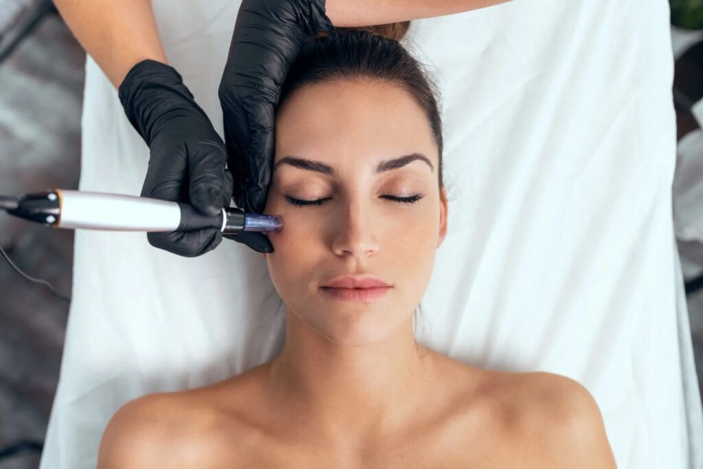 Revealing the Truth About Microneedling: Myths and Facts